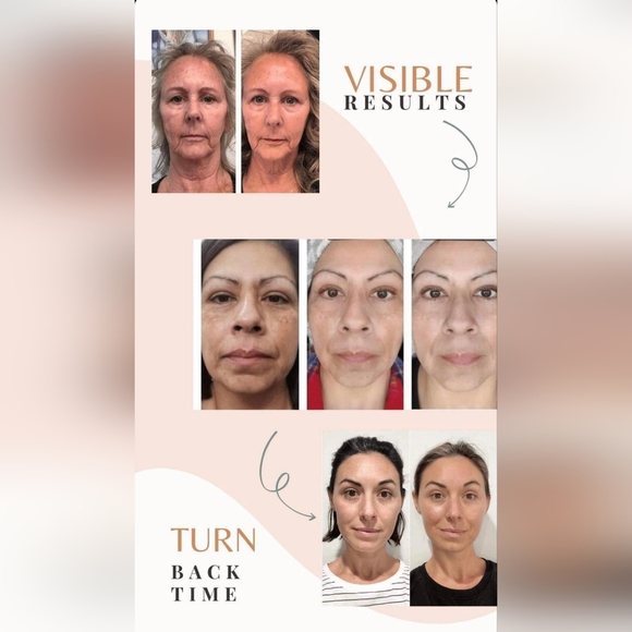 ✨ 93% absorbiton rate Liquid Collagen A. K. A. Liquid Gold 💫 - Picture 5 of 16